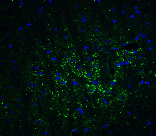 GABARAPL2 Antibody in Immunohistochemistry (Paraffin) (IHC (P))