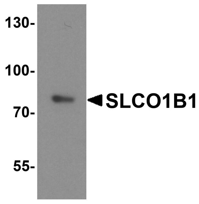 OATP2 Antibody in Western Blot (WB)