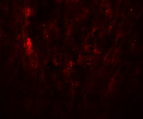 SOX10 Antibody in Immunohistochemistry (Paraffin) (IHC (P))