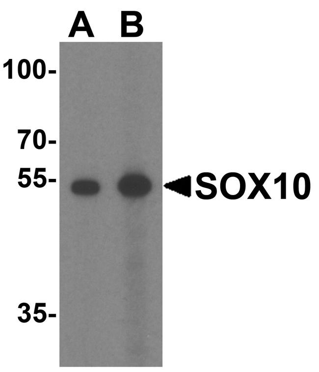 SOX10 Antibody in Western Blot (WB)