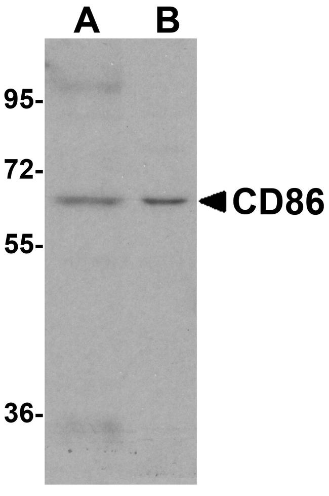 CD86 Antibody in Western Blot (WB)