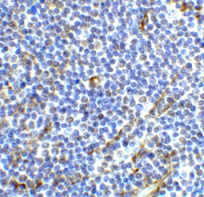 ICOS (CD278) Antibody in Immunohistochemistry (IHC)