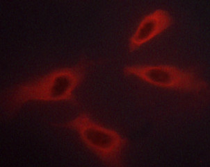 Phospho-c-Abl (Tyr226) Antibody in Immunocytochemistry (ICC/IF)