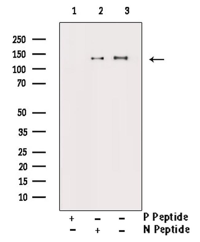 Phospho-c-Abl (Tyr226) Antibody in Western Blot (WB)