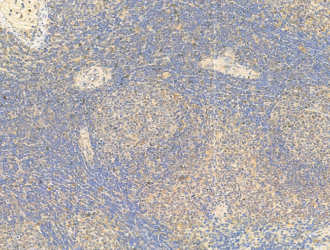 Phospho-C-Jun (Ser73) Antibody in Immunohistochemistry (Paraffin) (IHC (P))