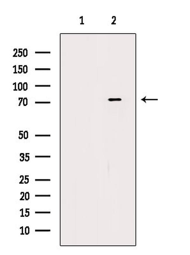 Phospho-DDX3 (Ser102) Antibody in Western Blot (WB)