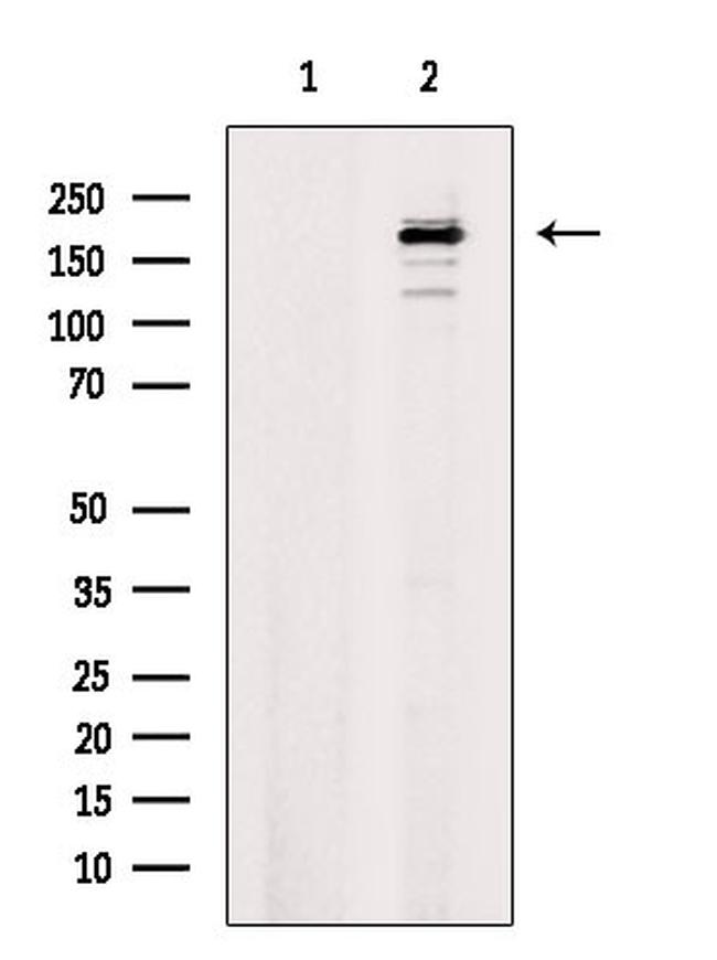 Phospho-DNMT1 (Ser714) Antibody in Western Blot (WB)