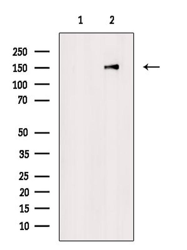 Phospho-DNMT1 (Tyr399) Antibody in Western Blot (WB)