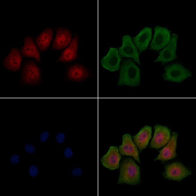 Phospho-HSF1 (Ser303) Antibody in Immunocytochemistry (ICC/IF)