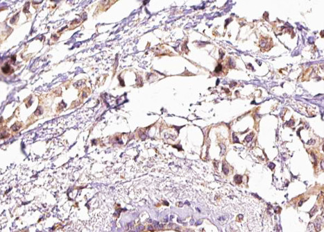 Phospho-HSF1 (Ser303) Antibody in Immunohistochemistry (Paraffin) (IHC (P))