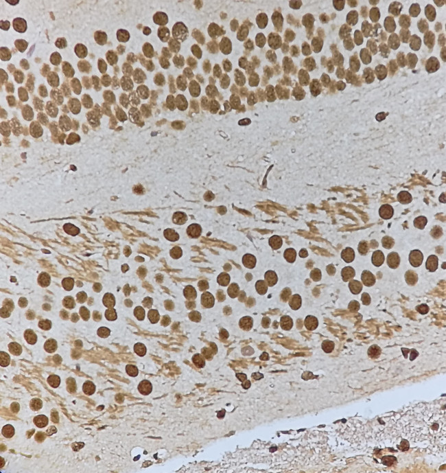 Phospho-HSF1 (Ser303) Antibody in Immunohistochemistry (Paraffin) (IHC (P))