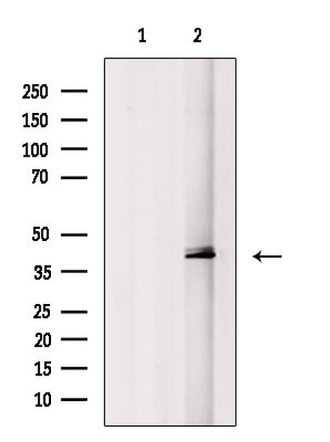 Phospho-MEK3/MEK6 (Ser189, Thr193) Antibody in Western Blot (WB)