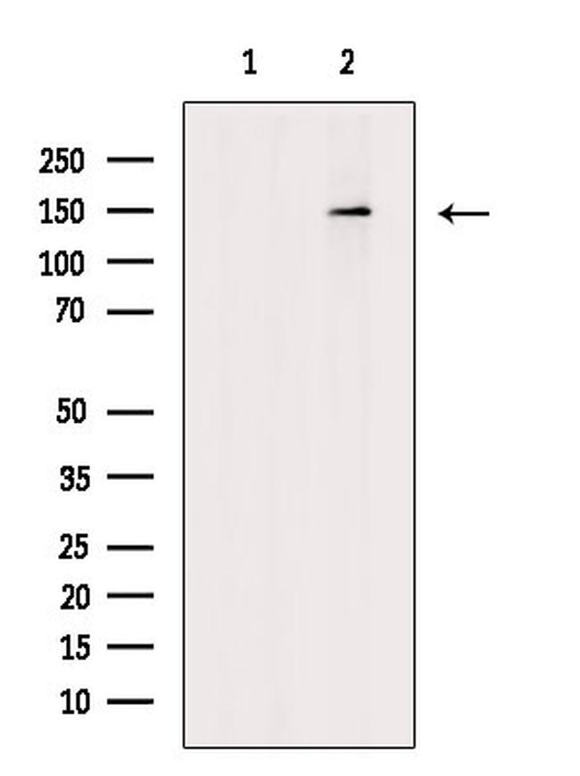 Phospho-MYPT1 (Ser473) Antibody in Western Blot (WB)