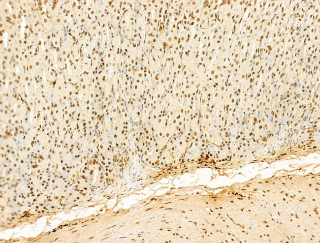 Phospho-RB1 (Ser780) Antibody in Immunohistochemistry (Paraffin) (IHC (P))