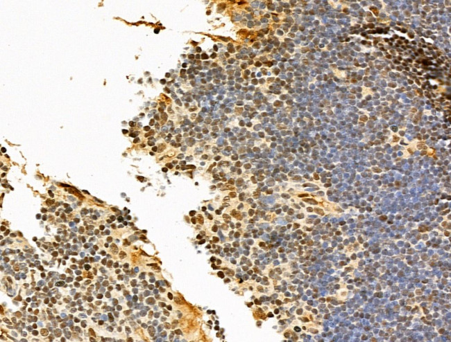 Phospho-RB1 (Ser780) Antibody in Immunohistochemistry (Paraffin) (IHC (P))