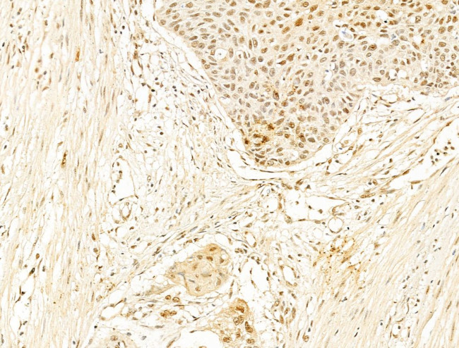 Phospho-RB1 (Ser780) Antibody in Immunohistochemistry (Paraffin) (IHC (P))