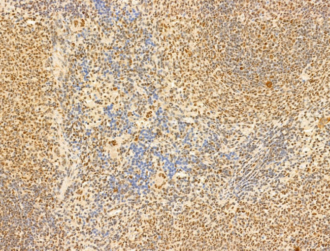 Phospho-RB1 (Ser780) Antibody in Immunohistochemistry (Paraffin) (IHC (P))