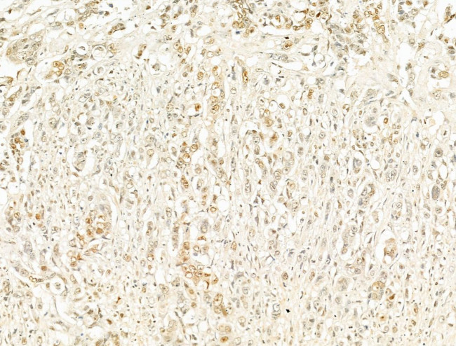 Phospho-RB1 (Ser780) Antibody in Immunohistochemistry (Paraffin) (IHC (P))