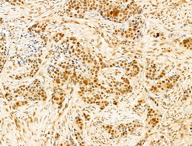 Phospho-RB1 (Ser780) Antibody in Immunohistochemistry (Paraffin) (IHC (P))