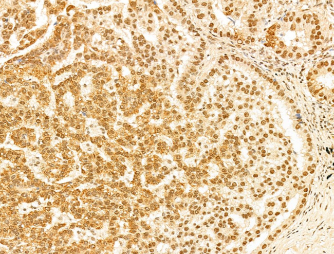 Phospho-RB1 (Ser780) Antibody in Immunohistochemistry (Paraffin) (IHC (P))