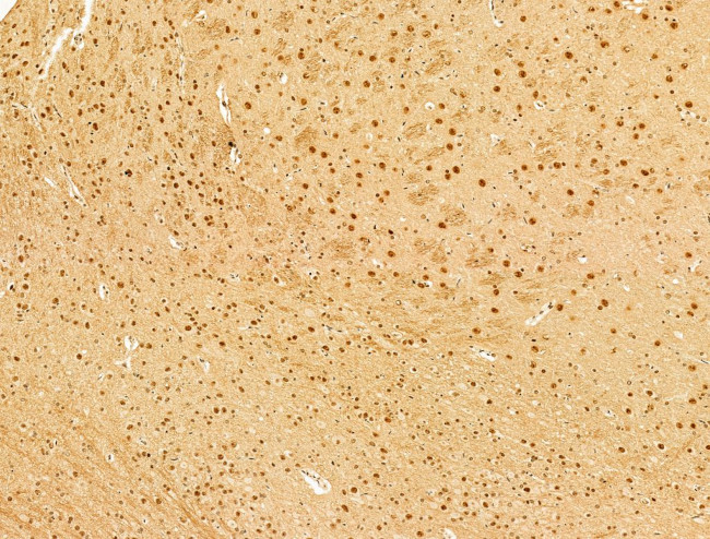 Phospho-RB1 (Ser780) Antibody in Immunohistochemistry (Paraffin) (IHC (P))