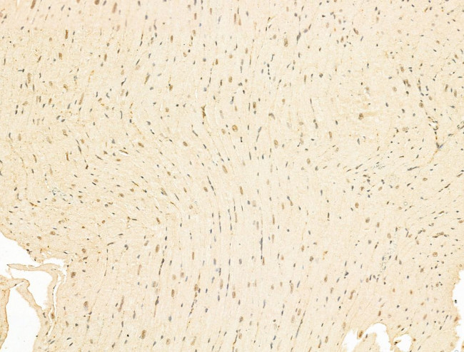 Phospho-RB1 (Ser780) Antibody in Immunohistochemistry (Paraffin) (IHC (P))