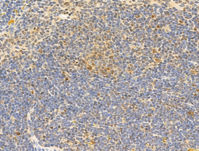 Phospho-RB1 (Ser780) Antibody in Immunohistochemistry (Paraffin) (IHC (P))