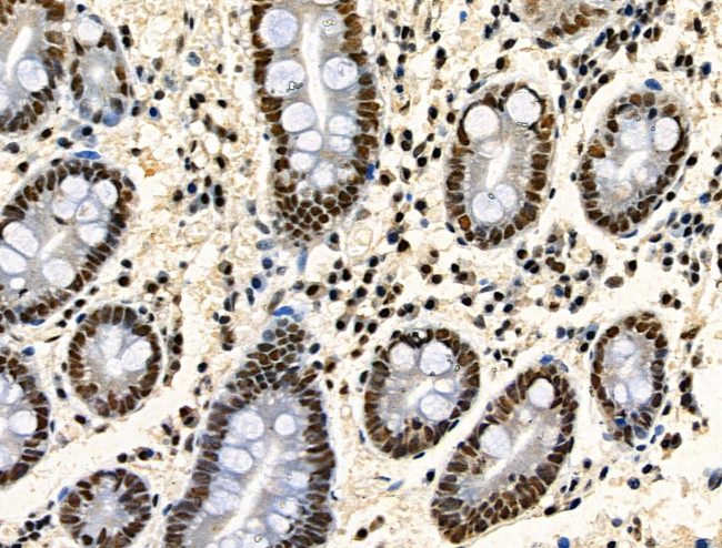 Phospho-TDP-43 (Ser409, Ser410) Antibody in Immunohistochemistry (Paraffin) (IHC (P))