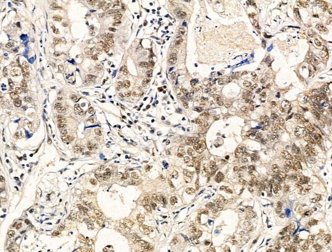 Phospho-TDP-43 (Ser409, Ser410) Antibody in Immunohistochemistry (Paraffin) (IHC (P))