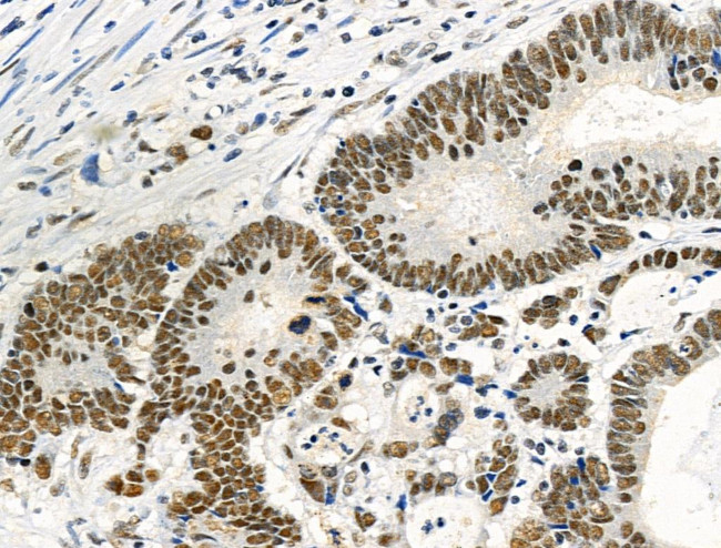 Phospho-TDP-43 (Ser409, Ser410) Antibody in Immunohistochemistry (Paraffin) (IHC (P))