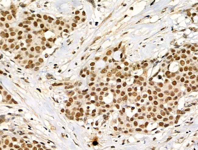 Phospho-TDP-43 (Ser409, Ser410) Antibody in Immunohistochemistry (Paraffin) (IHC (P))