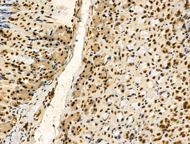 Phospho-TDP-43 (Ser409, Ser410) Antibody in Immunohistochemistry (Paraffin) (IHC (P))