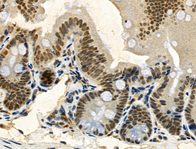 Phospho-TDP-43 (Ser409, Ser410) Antibody in Immunohistochemistry (Paraffin) (IHC (P))