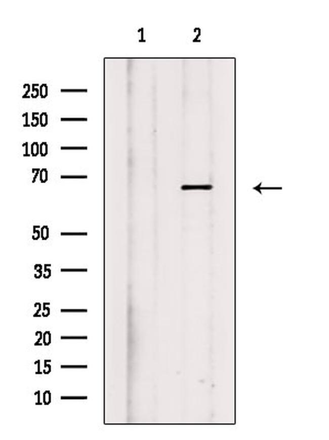 Phospho-TGFBR2 (Ser553) Antibody in Western Blot (WB)