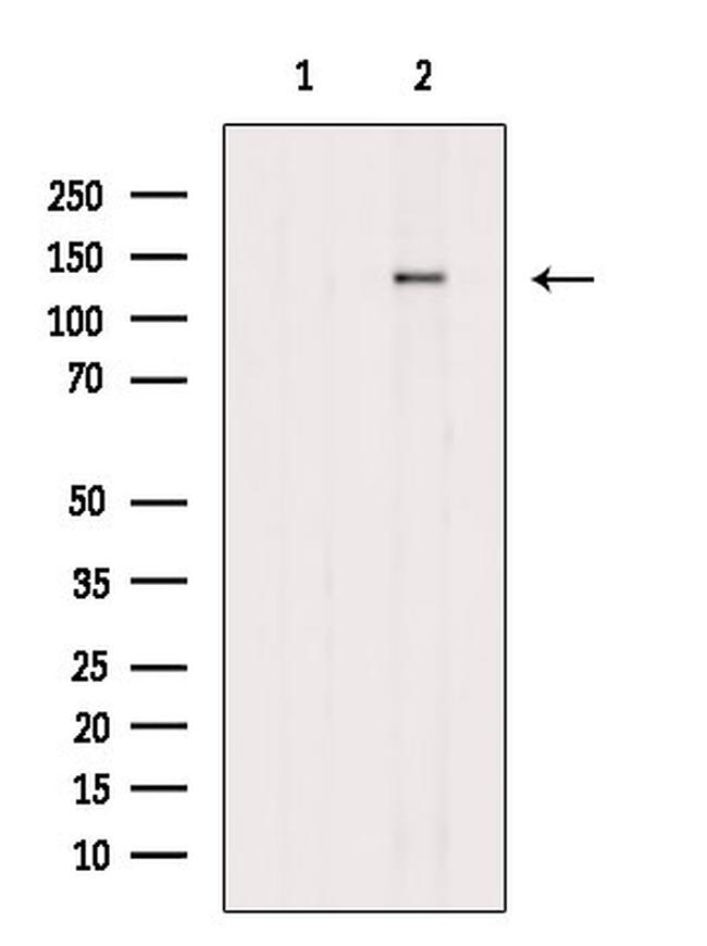 Phospho-ZEB2 (Ser784) Antibody in Western Blot (WB)