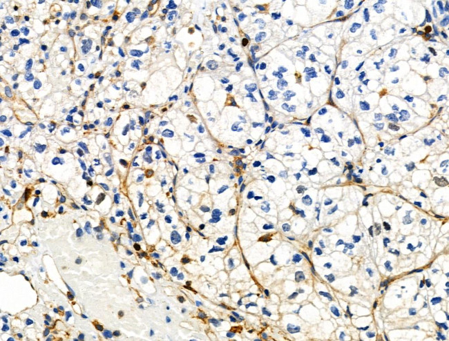 Phospho-ZO-2 (Tyr1118) Antibody in Immunohistochemistry (Paraffin) (IHC (P))