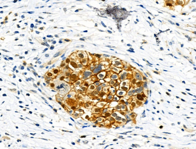 Phospho-ZO-2 (Tyr1118) Antibody in Immunohistochemistry (Paraffin) (IHC (P))