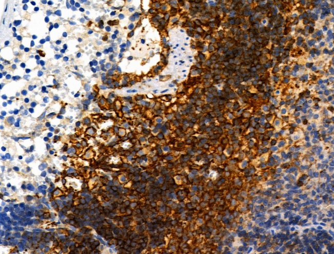 Phospho-ZO-2 (Tyr1118) Antibody in Immunohistochemistry (Paraffin) (IHC (P))