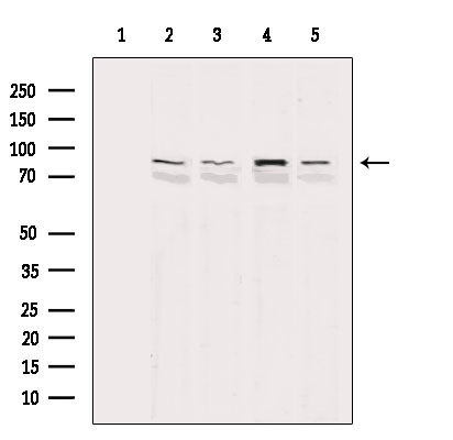 PARP1 (Cleaved Asp214) Antibody in Western Blot (WB)