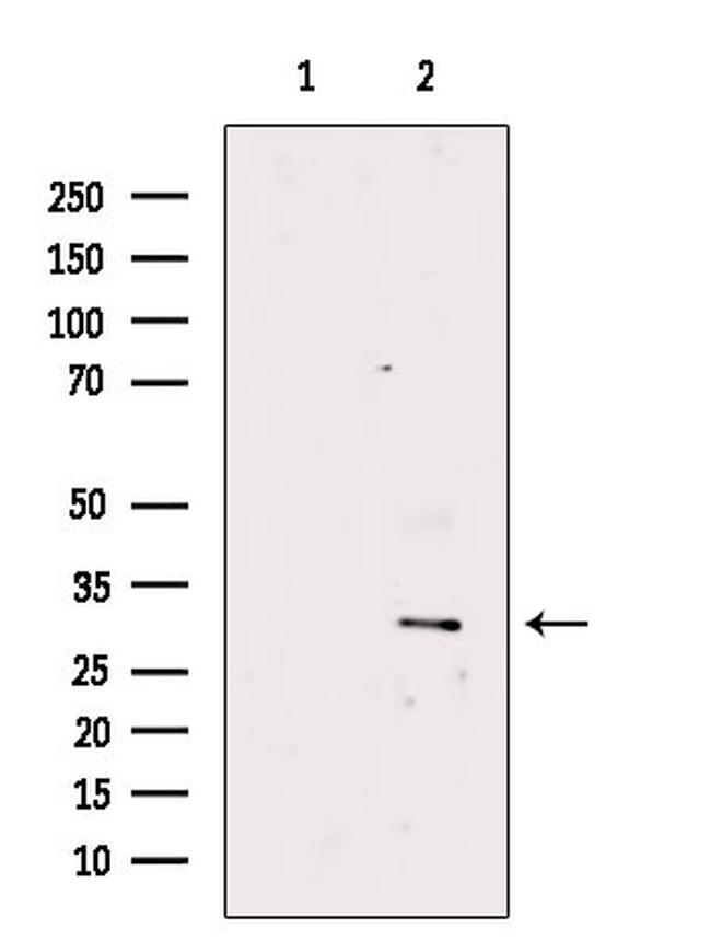 CACNG5 Antibody in Western Blot (WB)