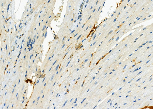 CACNG8 Antibody in Immunohistochemistry (Paraffin) (IHC (P))