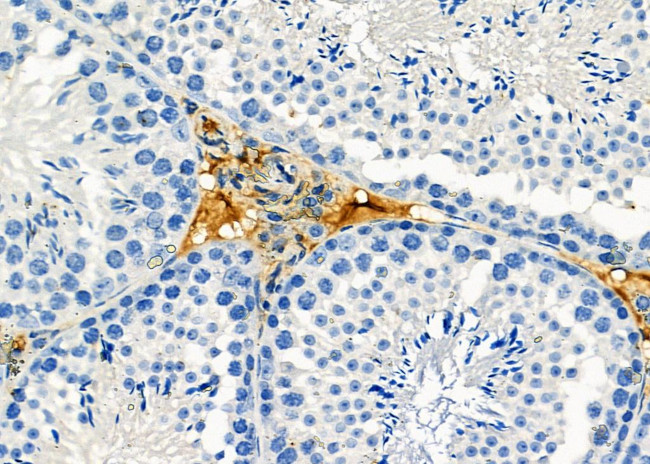 CACNG8 Antibody in Immunohistochemistry (Paraffin) (IHC (P))