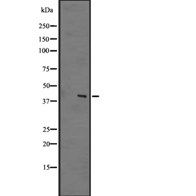 GPR183 Antibody in Western Blot (WB)