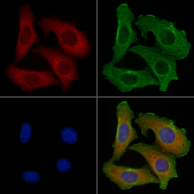 PKC eta Antibody in Immunocytochemistry (ICC/IF)