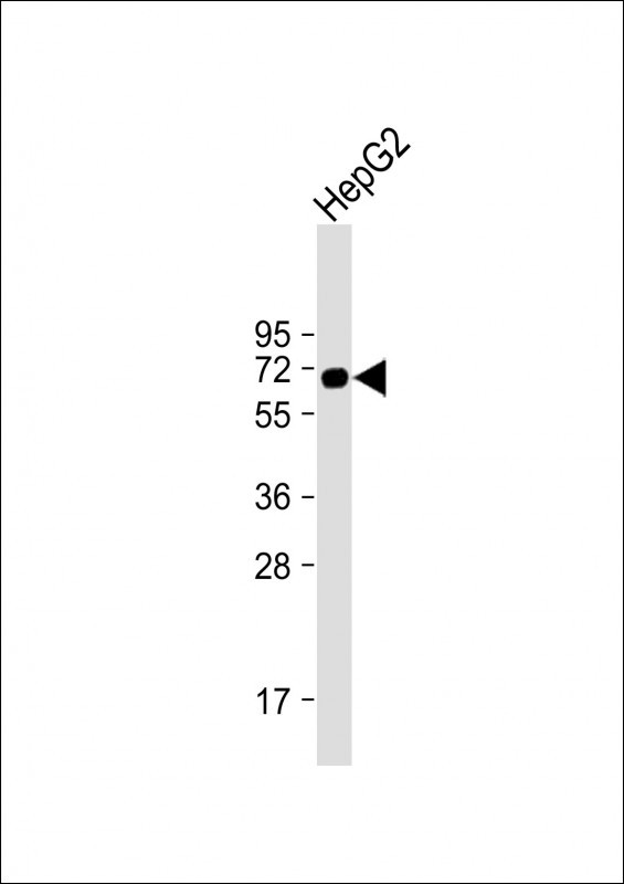 AFP Antibody in Western Blot (WB)