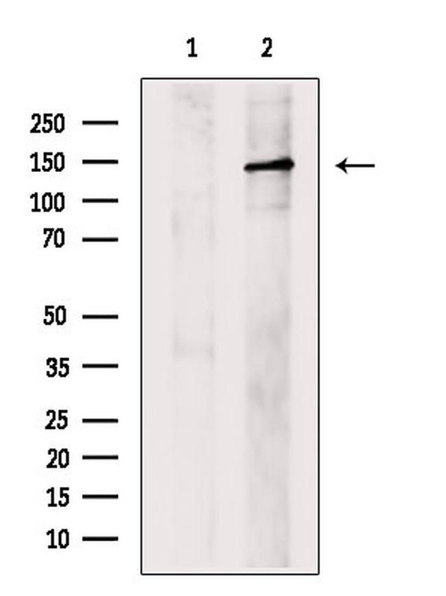 ABCB11 Antibody in Western Blot (WB)