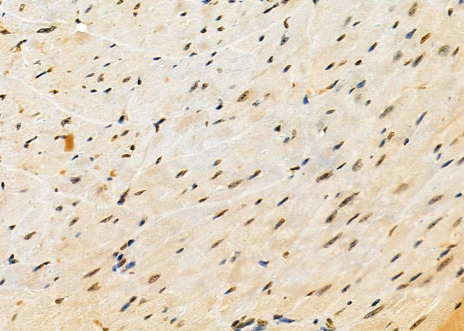 ACBD7 Antibody in Immunohistochemistry (Paraffin) (IHC (P))