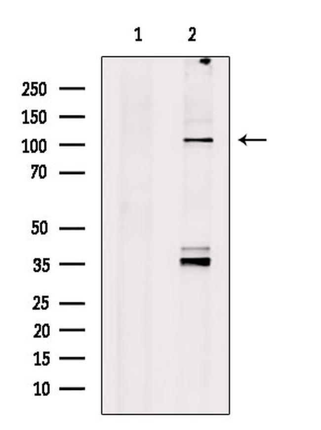Spectrin alpha-1 Antibody in Western Blot (WB)