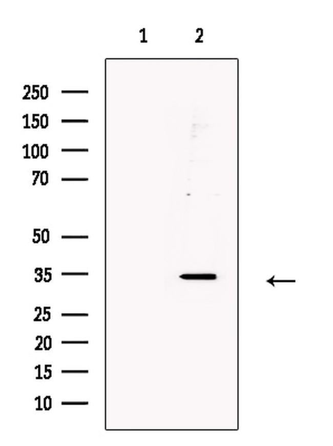 CD297 Antibody in Western Blot (WB)
