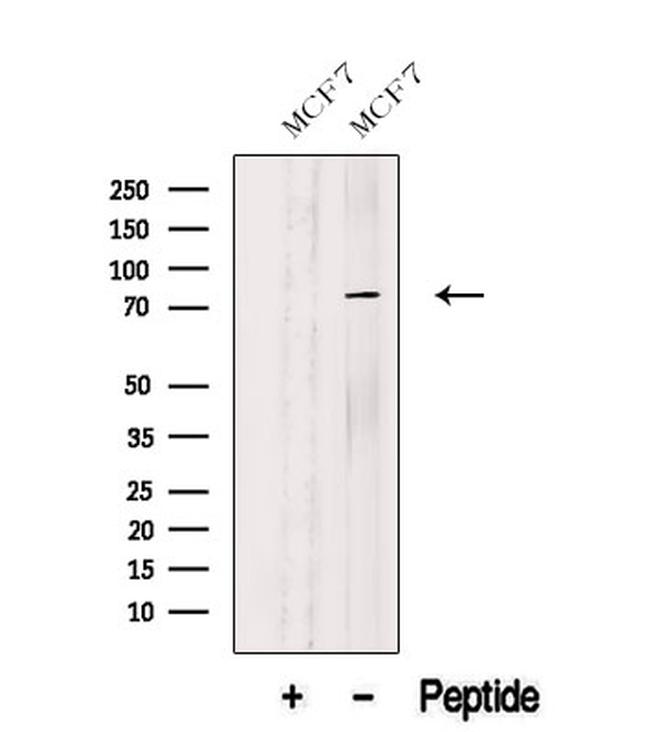 C12orf11 Antibody in Western Blot (WB)